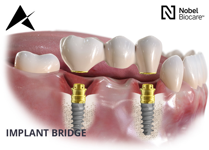 Airport Dental Implant Centre Cork